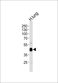 RAGE Antibody (Center)
