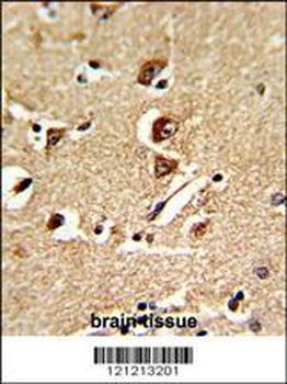 GNPAT Antibody (C-term)