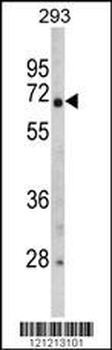 GNPAT Antibody (C-term)