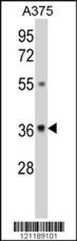 GALE Antibody (Center)