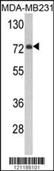 FMO3 Antibody (N-term)