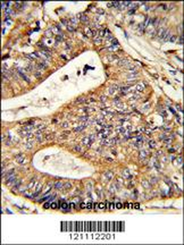 CALR Antibody (Center)