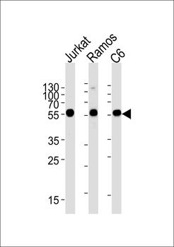CALR Antibody (Center)