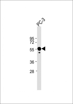 CALR Antibody (Center)
