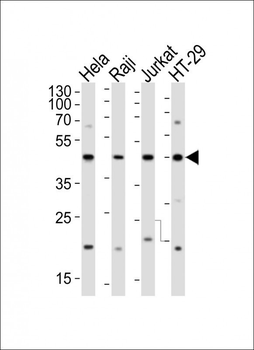 GLUL Antibody (N-term)