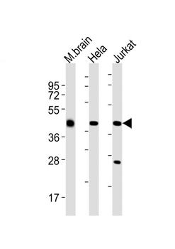 GLUL Antibody (N-term)