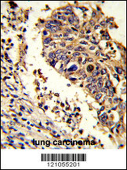 LUC7L Antibody (C-term)