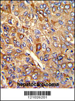 FTH1 Antibody (C-term)