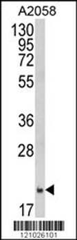 FTH1 Antibody (C-term)