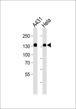 GTF2I Antibody (C-term)
