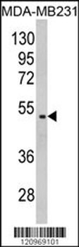 GALT Antibody (C-term)