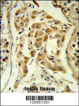 ESPN Antibody (N-term)