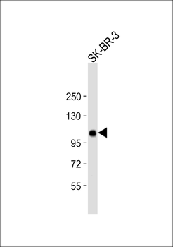 ESPN Antibody (N-term)