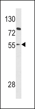 PAX8 Antibody (Center)
