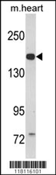 CORIN Antibody (Center)