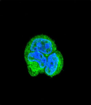 ASPA Antibody (N-term)