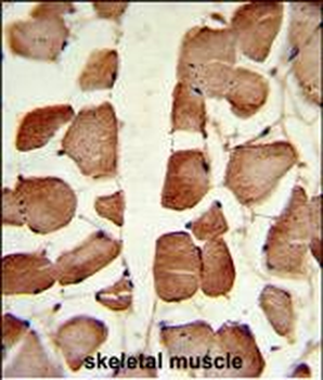 ASPA Antibody (N-term)