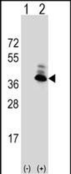 ASPA Antibody (N-term)