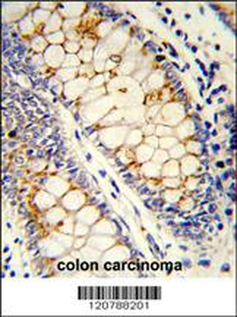 SFRS1 Antibody (C-term)