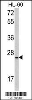 SFRS1 Antibody (C-term)