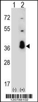 SFRS1 Antibody (C-term)