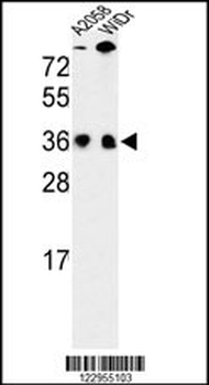 SFRS1 Antibody (N-term)