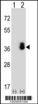 SFRS1 Antibody (N-term)