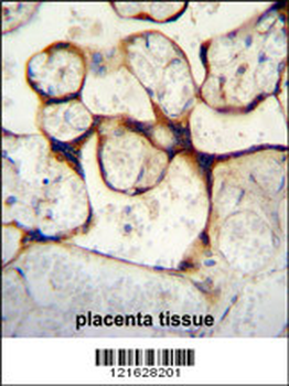 ECE1 Antibody (Center)