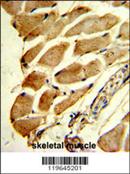 FHL1 Antibody (C-term)