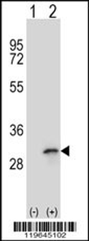 FHL1 Antibody (C-term)