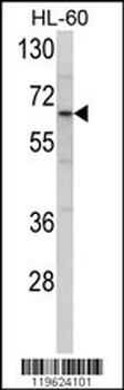 ENTH Antibody (Center)