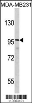 DLGAP1 Antibody (N-term)