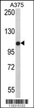 TCPR1 Antibody (N-term)