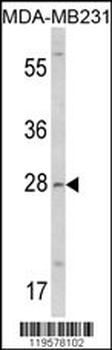 COLEC11 Antibody (N-term)
