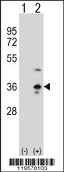COLEC11 Antibody (N-term)
