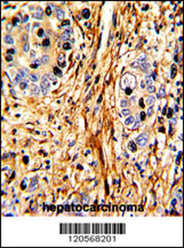 LAMB2 Antibody (C-term)