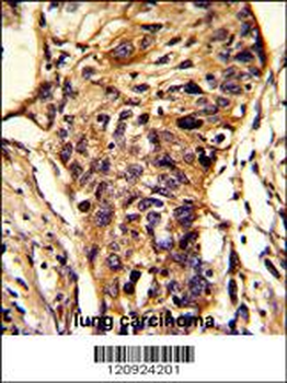 BCKDHA Antibody (C-term)