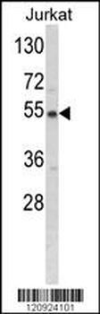 BCKDHA Antibody (C-term)
