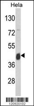ASS Antibody (Center)
