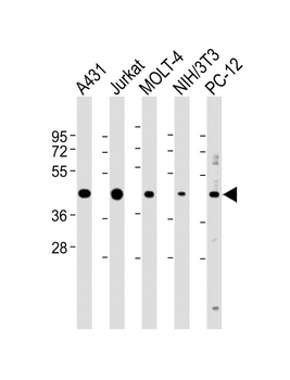 ASS Antibody (Center)