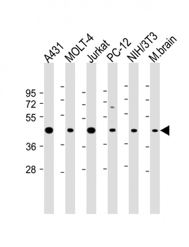ASS Antibody (Center)