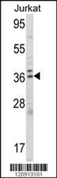 ALAD Antibody (C-term)