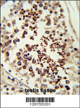 SMAC Antibody (C-term)