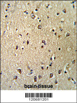 KPNB1 Antibody (N-term)