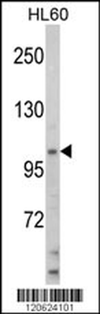 HIP116A Antibody (Center)