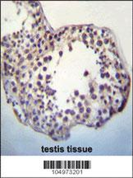 TPTEa Antibody (N-term)