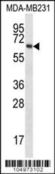 TPTEa Antibody (N-term)