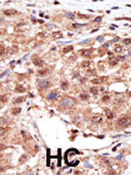 MTM1 Antibody (N-term)