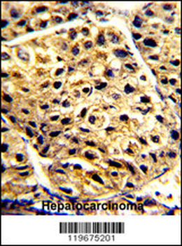AADAC Antibody (C-term)