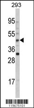 AADAC Antibody (C-term)